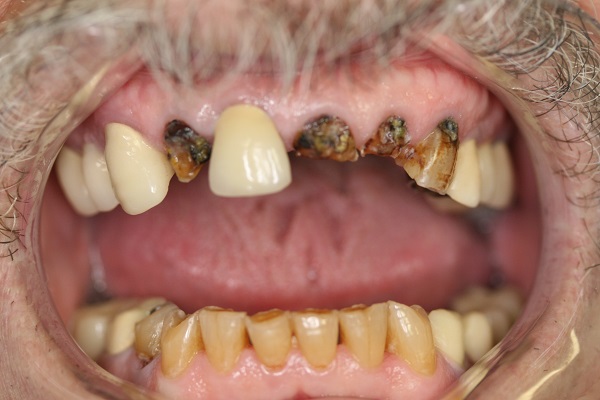 family-pic-2013-some-teeth-091-1
