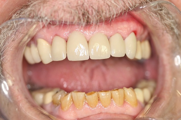 family-pic-2013-some-teeth-092